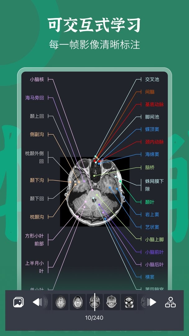 万康人体解剖极速版截图2